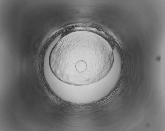 X0000116281448201001111025