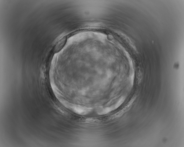 X0000116281449201001111025