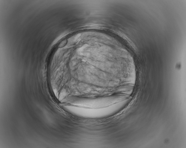 X0000116281450201001111025