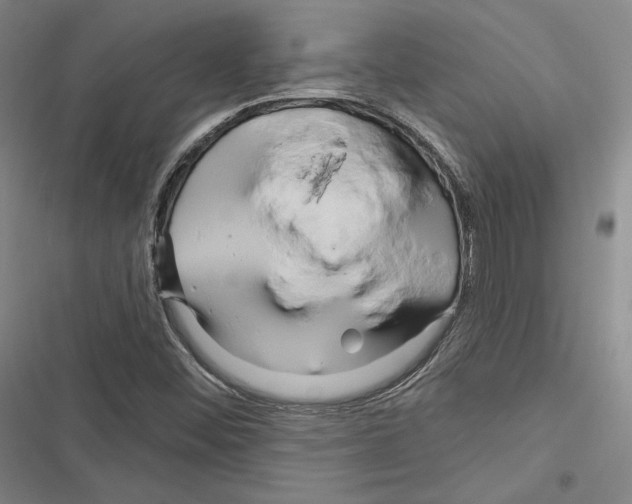 X0000116281452201001111025