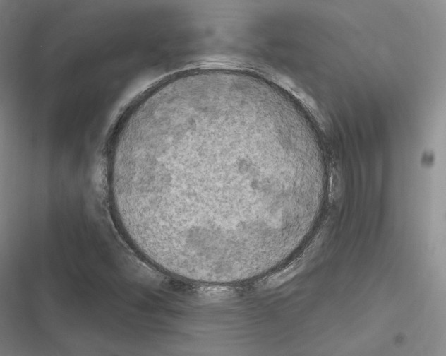 X0000116281454201001111025