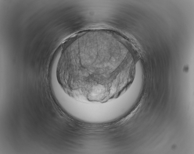 X0000116281457201001111025