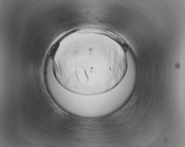 X0000116281460201001111025