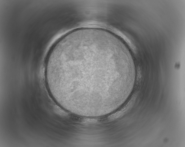 X0000116281462201001111025