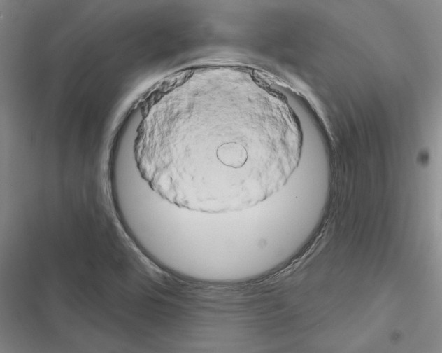 X0000116281464201001111025