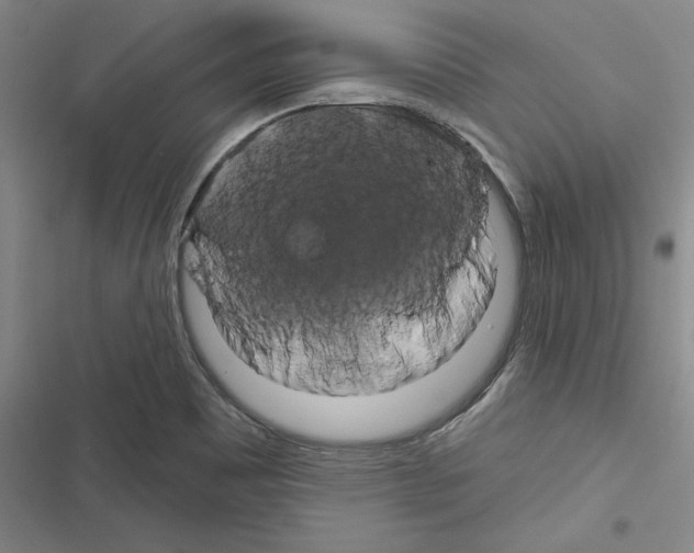 X0000116281465201001111025