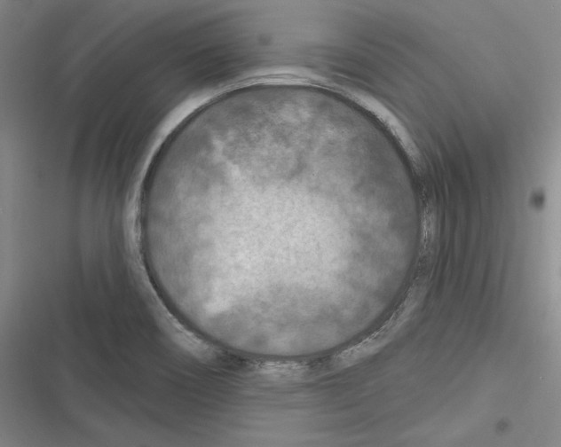 X0000116281466201001111025