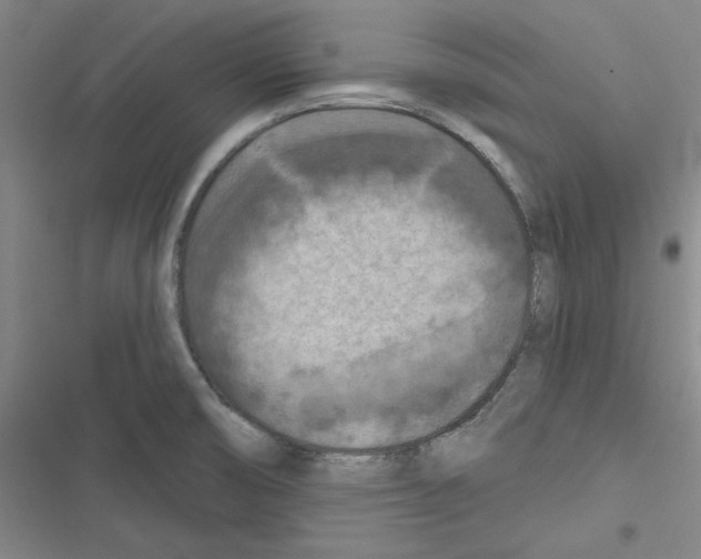 X0000116281474201001111025