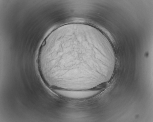 X0000116281475201001111025