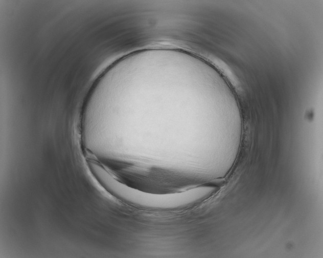 X0000116281476201001111025