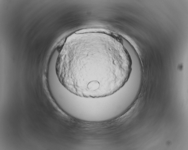 X0000116281477201001111025