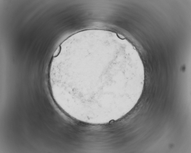 X0000116281479201001111025
