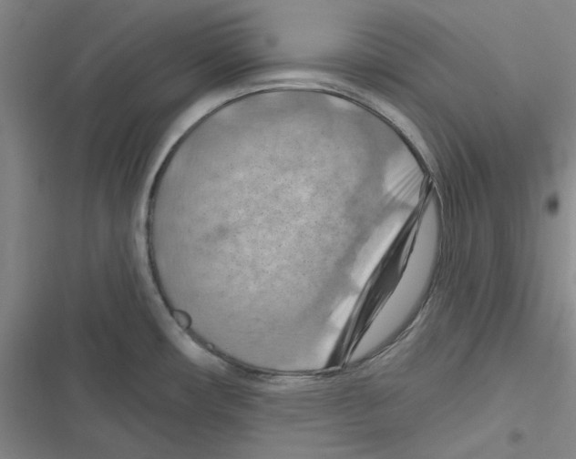 X0000116281482201001111025