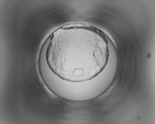 X0000116281485201001111025