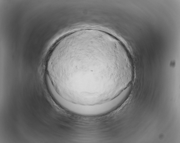 X0000116281503201001111024