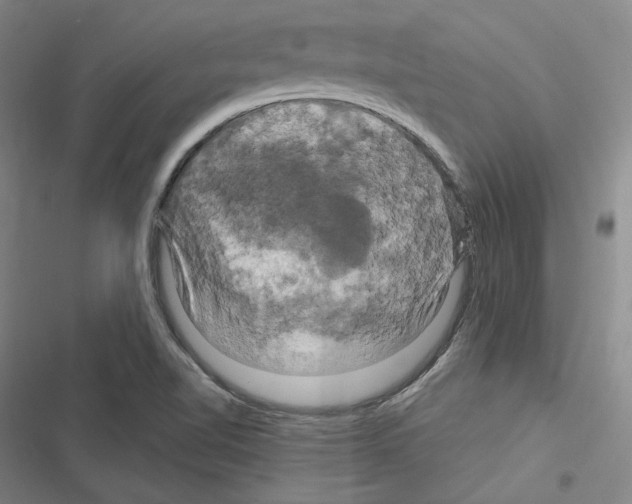 X0000116281510201001111024