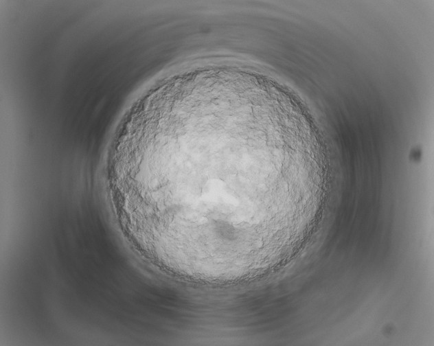 X0000116281514201001111024