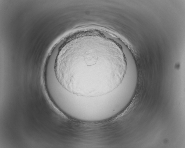 X0000116281518201001111024