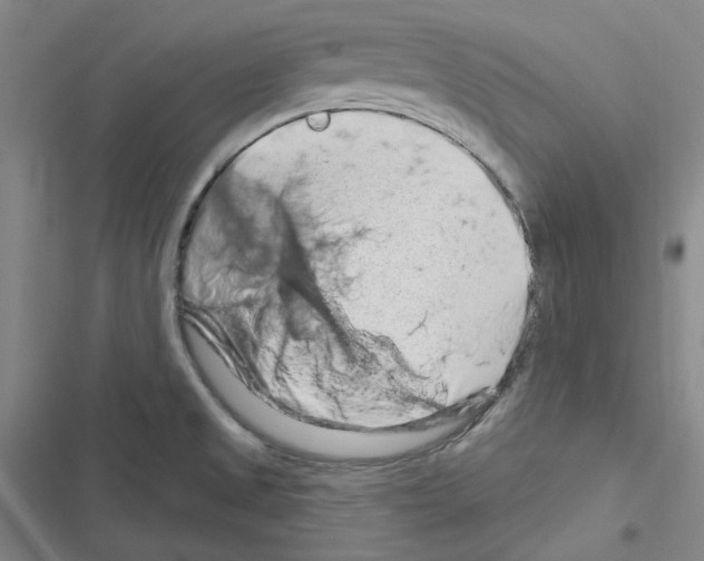 X0000116281525201001111025