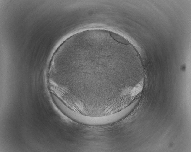 X0000116281527201001111025