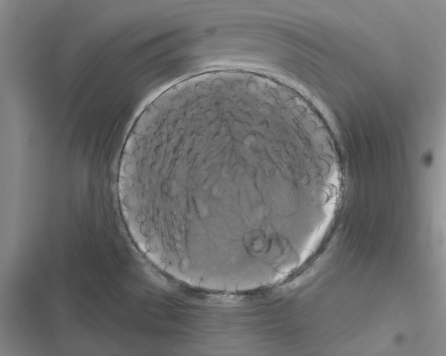 X0000116281529201001111025