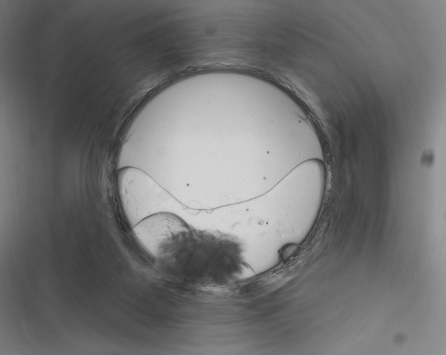 X0000116300115201001111125