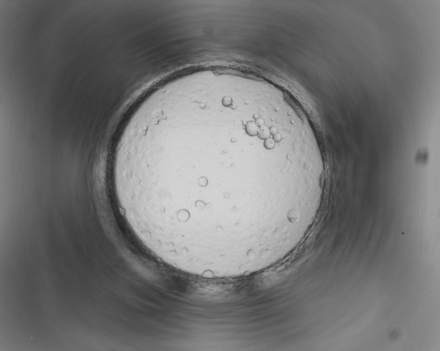 X0000116300155201001111125