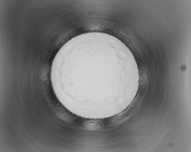 X0000116300175201001111125