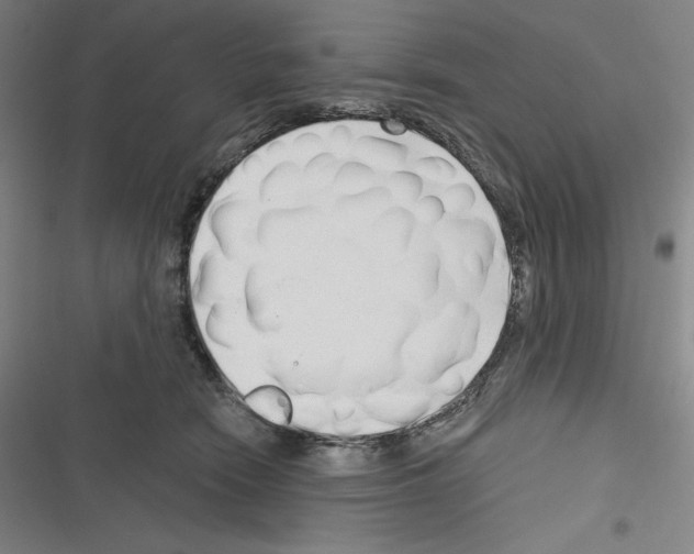 X0000116300466201001111121