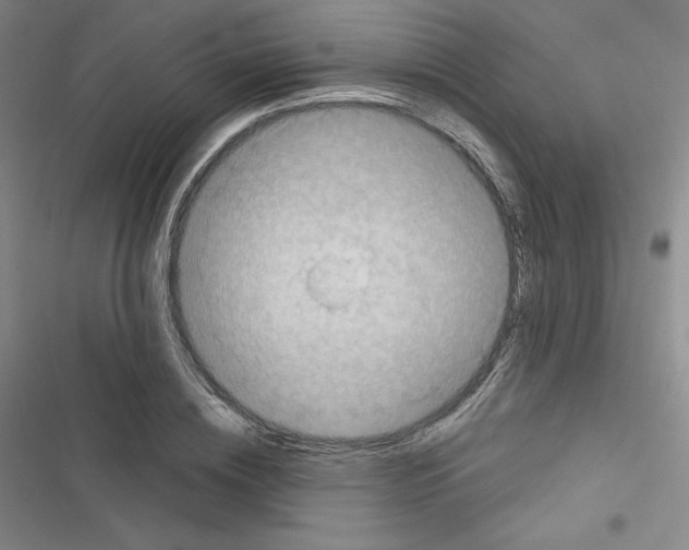 X0000116300836201001111116