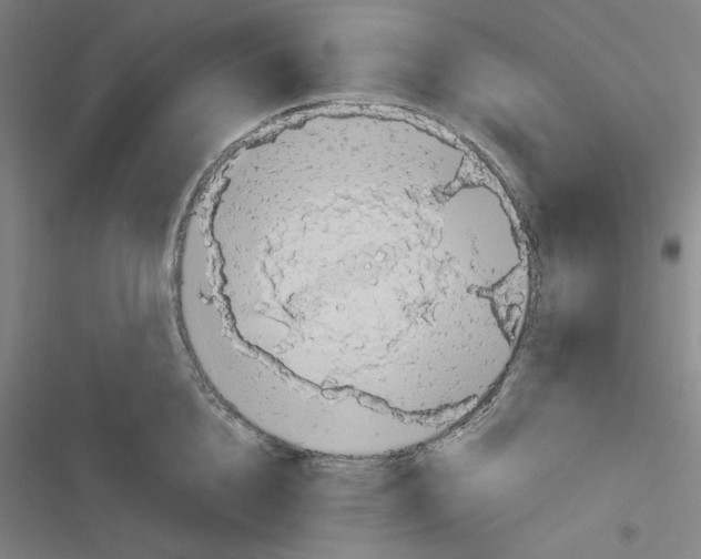 X0000116300856201001111116