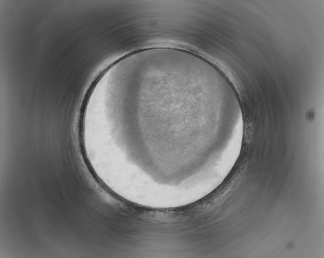 X0000116300995201001111113