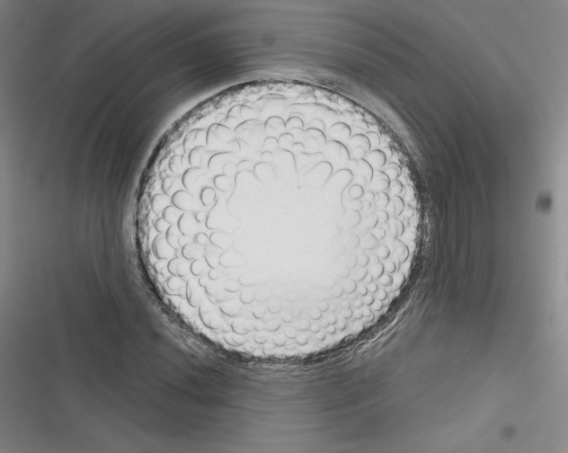 X0000116301020201001111113