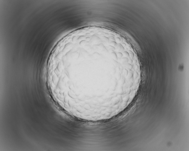 X0000116301036201001111113