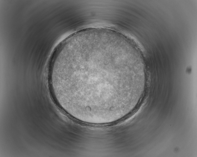 X0000116301114201001111111