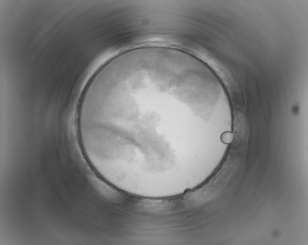 X0000116301474201001111107