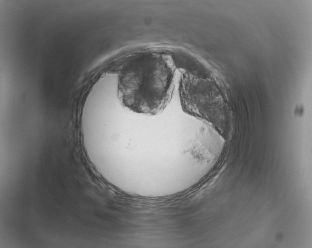 X0000116301494201001111106