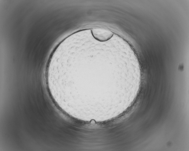 X0000116301517201001111107