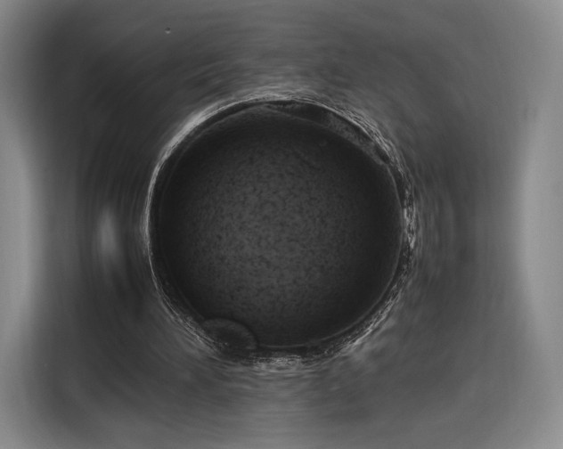 X0000116310196200912071315