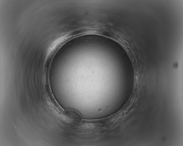 X0000116310149200912141407