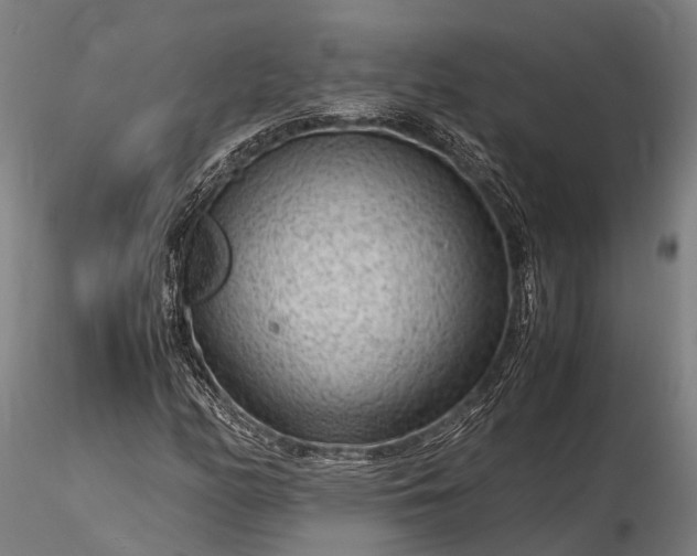 X0000116311158200912141352