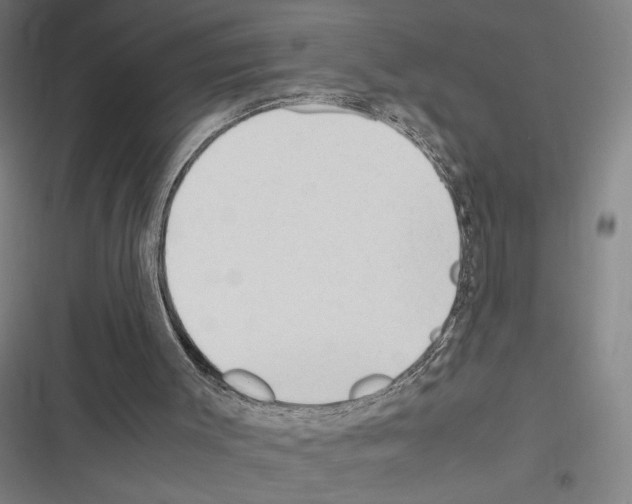 X0000116310003201001111148