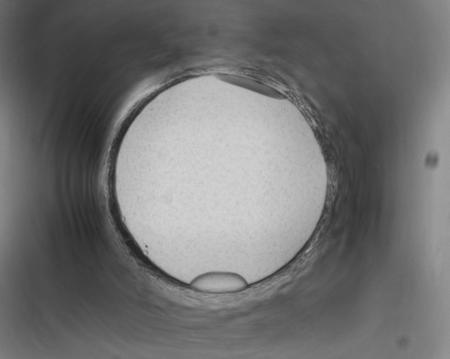 X0000116310006201001111148