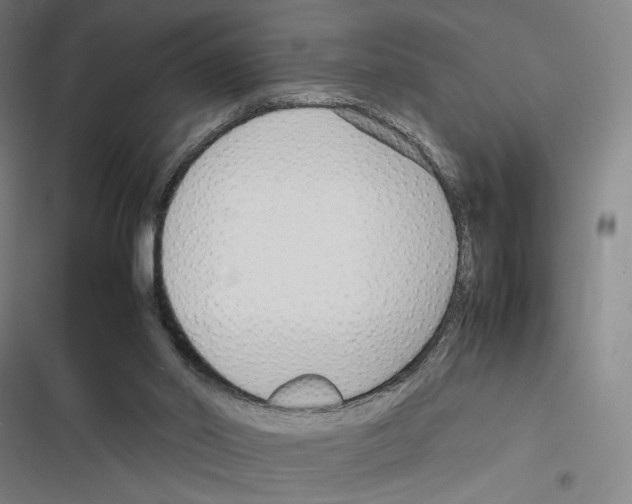 X0000116310014201001111148