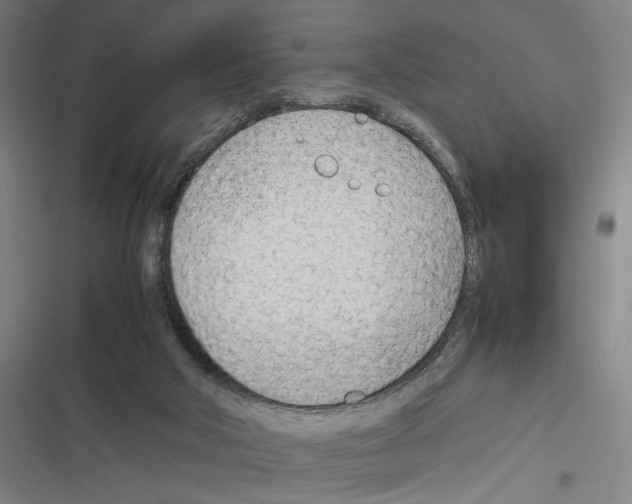 X0000116310018201001111148