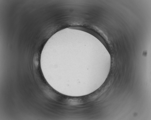 X0000116310069201001111147