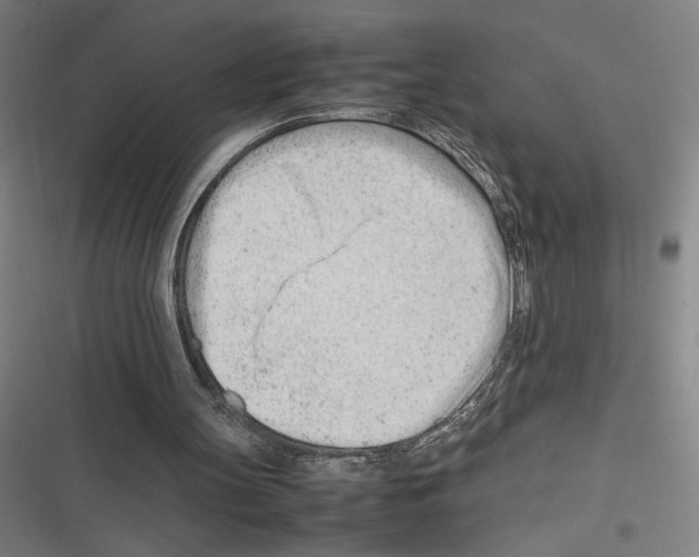 X0000116310147201001111145