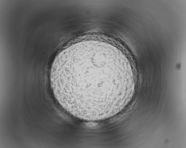 X0000116310265201001111144