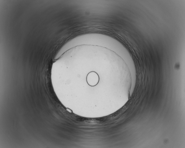 X0000116310316201001111144