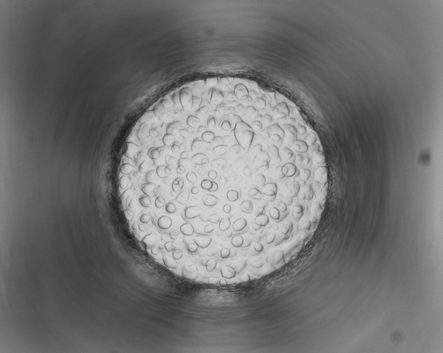 X0000116310354201001111143